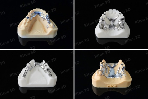 Nenhum equipamento de impressão dental de Digitas 3D do laboratório de Industrial 500W da impressora do metal 3D do laser da vibração