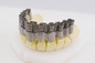 Impressora dental de Dual Fiber Laser Digital 20-60μM Crowns And Dentures 3D da impressora do FCC 3D