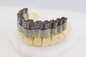 Única indústria de For Dental Jewelry da impressora do metal do laser 3D da fibra