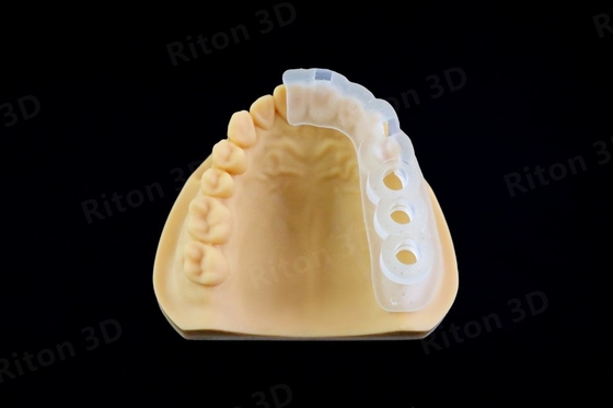 Resina cirúrgica do guia da baixa viscosidade para a impressora 3d modelo dental