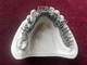 Impressão dental de One Stop Denture da impressora do titânio 3D da liga do cromo do cobalto